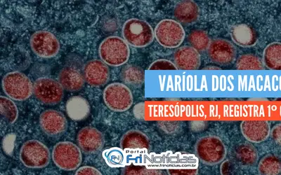 Teresópolis, RJ, registra o primeiro caso de Varíola dos macacos